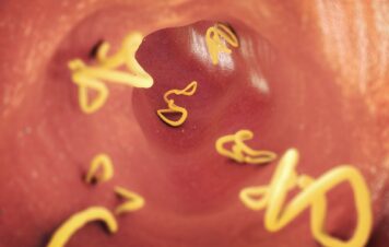 Glista ludzka - objawy i leczenie